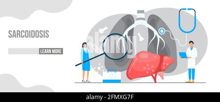 Konzeptvektor Sarkoidose Awareness Month. Jedes Jahr im April wird ein medizinisches Ereignis beobachtet. Sarkoidose, mit abnormalen Ansammlungen von Inflammat Stock Vektor