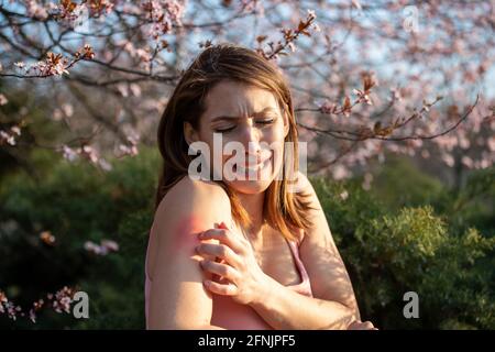 Hübsche junge Frau, die im Frühling neben einem blühenden Baum im Park den Arm kratzt. Rötung und juckende Haut als allergische Reaktion Stockfoto