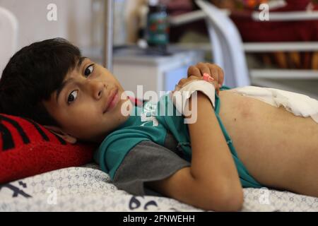 Gaza-Stadt. Mai 2021. Ein palästinensisches Kind wurde beim Spielen in der Nähe der Tür seines Hauses verletzt, nachdem israelische Kampfflugzeuge ihn mit einer Reihe von Kindern im Viertel Al-Zaytoun, östlich von Gaza-Stadt, anvisiert hatten. Stockfoto