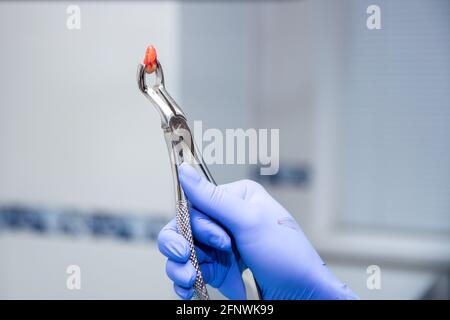 Gezogen Zahn in der metallischen Pinzetten und wenig Blut auf dem Zahn. Zahnarzt Hand in den Gummi medizinische blau Handschuh mit der Pinzette. Nur extrahierte Zahn Stockfoto