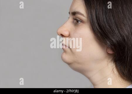 Die Frau hat ein Doppelkinn. Behandlung, Kinnumformung, Fettentfernung, Lifting. Platz für Textkopie Stockfoto