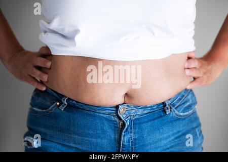 Fat Woman Belly Taste Und Body On Diet Stockfoto