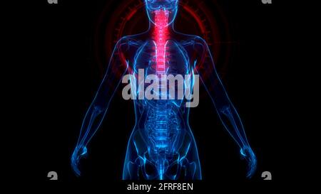 cg Medicine 3d-Illustration, zervikaler, oberer Teil der menschlichen Wirbelsäule auf Röntgenkörper Stockfoto