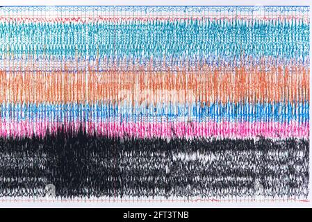 Aufnahme von Hirnwellen während eines Anfalls oder von EEG-Anfallswellen mit hohen Amplituden und hoher Frequenz. Stockfoto