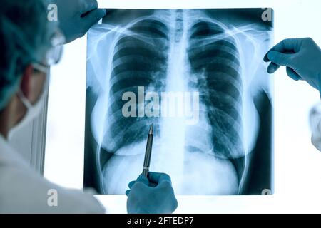 Nahaufnahme. Ärzte in Schutzkleidung diskutieren eine Röntgenaufnahme der Lunge . Stockfoto