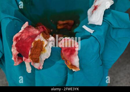 Gebrauchte chirurgische Gaze mit Blut gefärbt und antiseptisch auf Müll Behälter im Operationssaal Stockfoto