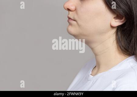 Die Frau hat ein Doppelkinn. Behandlung, Kinnumformung, Fettentfernung, Lifting. Platz für Textkopie Stockfoto