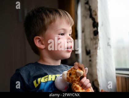 Ein Junge mit schwarzem Auge und Spielzeug in den Händen schaut träumerisch aus dem Fenster. Der blaue Fleck hindert ihn nicht daran, wieder Freunde zu erreichen Stockfoto