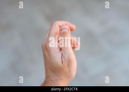 Nahaufnahme einer linken Hand mit einem Daumen Mit einem weißen und gebissenen Nagel Zustand Stockfoto