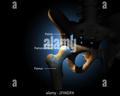 3D-Abbildung mit Hüftgelenk, beschriftet Stockfoto