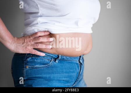 Fat Woman Belly Taste Und Body On Diet Stockfoto