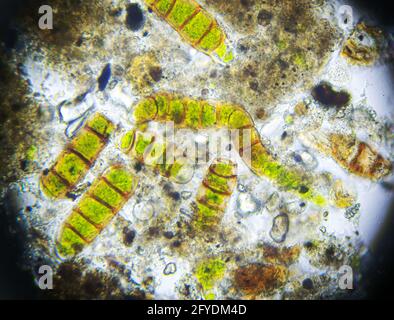 Mikroalgen unter dem Mikroskop, Probe aus Moos entnommen Stockfoto