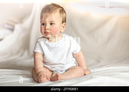 LONDON, VEREINIGTES KÖNIGREICH - Aug 27, 2020: Atopisches Dermatitis Ekzem bei Baby.Zustand, der die Haut zu rot, trocken, wund, juckend und rissig verursacht.Atopic Stockfoto