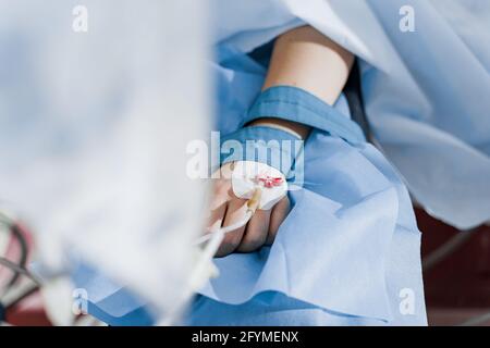 Katheter sicher in Frau Hand auf plastische Operation Anästhesie für die Operation eingeführt. Stockfoto
