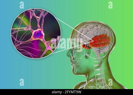 Menschlicher Schläfenlappen und Neuronen, Illustration Stockfoto