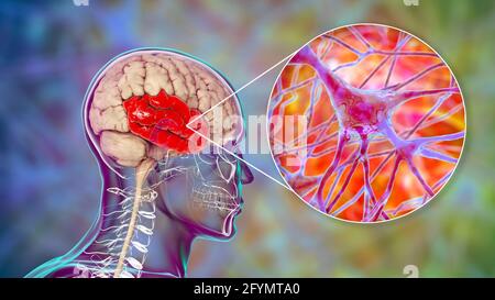 Menschlicher Schläfenlappen und Neuronen, Illustration Stockfoto