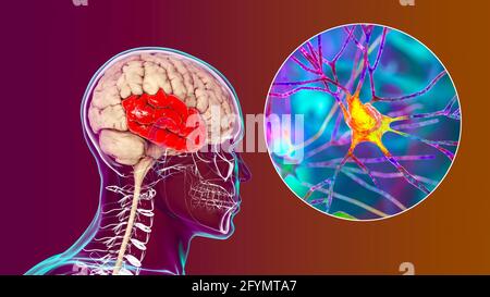 Menschlicher Schläfenlappen und Neuronen, Illustration Stockfoto