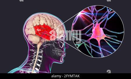 Menschlicher Schläfenlappen und Neuronen, Illustration Stockfoto