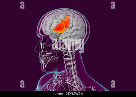 Gehirn mit hervorgehobener frontaler Gyrus inferior, Illustration Stockfoto