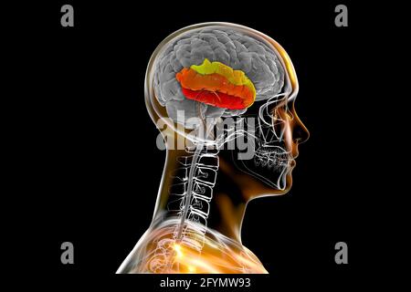 Menschliches Gehirn mit hervorgehobener temporaler Gyri, Illustration Stockfoto