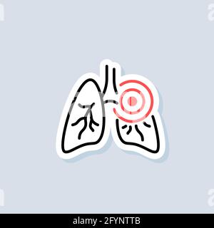 Aufkleber „Lunge“. Symbol für Lungenentzündung. Entzündlich in der Lunge. Asthma oder Tuberkulose. Vektor auf isoliertem Hintergrund. EPS 10. Stock Vektor