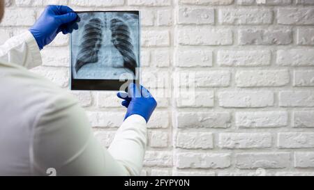 Röntgenaufnahme der menschlichen Lunge. Der Arzt diagnostiziert den Patienten. Röntgen des Thorax. Stockfoto