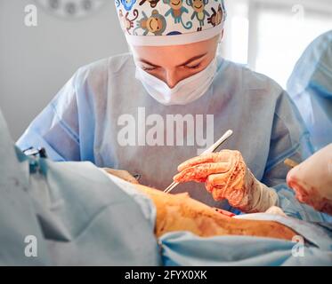 Weibliche Chirurgen in der medizinischen Maske Durchführung Bauchdeckenoperation im Operationssaal. Junge Ärztin trägt OP-Uniform und sterile Handschuhe, während sie im Krankenhaus eine plastische Bauchoperation macht. Stockfoto