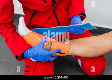 Krankenschwester Bandagen das Bein. Bruch der unteren Gliedmaßen. Behandlung von gebrochenen Knochen. Ein Gips verhängen. Patienten der chirurgischen Abteilung. Der Arzt die Hände Stockfoto