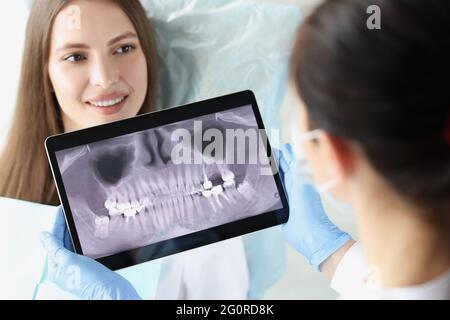 Der Zahnarztarzt untersucht die Röntgenaufnahme des weiblichen Kiefers Stockfoto