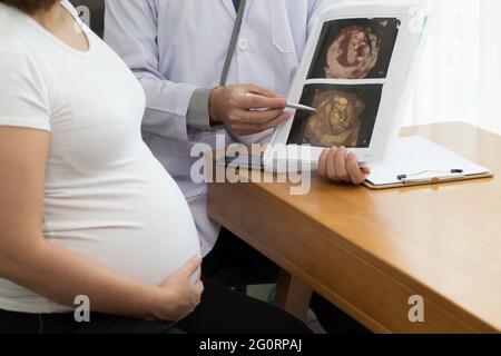 Arzt hält das 4D-Ultraschallbild und spricht mit der Schwangeren. Während der Schwangerschaft Konzept Stockfoto