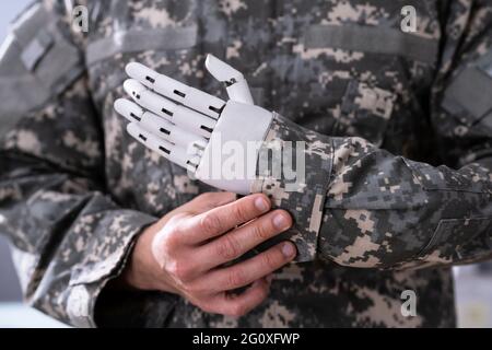 Soldat Künstliche Prothesen Extremitätenhand. Kriegsveteran Stockfoto