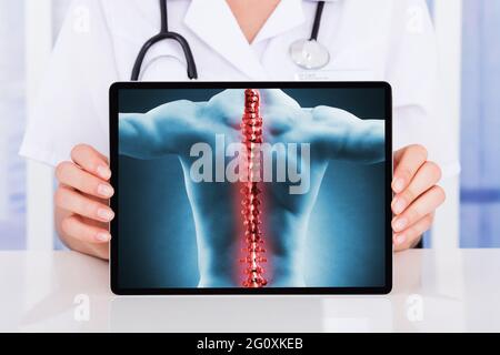 Rückenschmerzen Und Osteoporose Der Gelenke. Orthopädische Rückenschmerzen Stockfoto