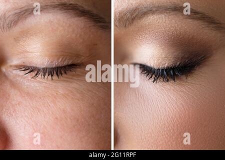 Frau Gesicht Haut Make-Up. Vorher Und Nachher Vergleichen Stockfoto