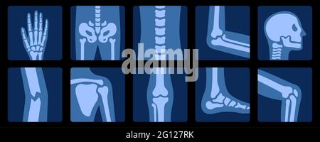 Röntgenaufnahme von Knochen. Röntgenuntersuchung der Anatomie des menschlichen Gelenks. Illustration für Medizin, Bildung und Wissenschaft. Stock Vektor