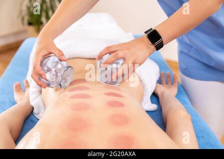 Frau erhält eine Schröpfbehandlung in einem Spa. Schröpftherapie. Behandlung in der traditionellen chinesischen Medizin zur Schmerzlinderung und anderen gesundheitlichen Vorteilen. Stockfoto