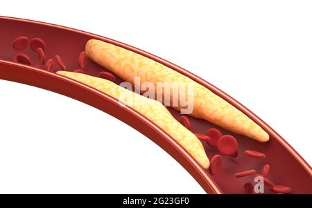 Fett- und rote Blutkörperchen in Blutgefäßen, 3d-Rendering. Digitale Zeichnung des Computers. Stockfoto