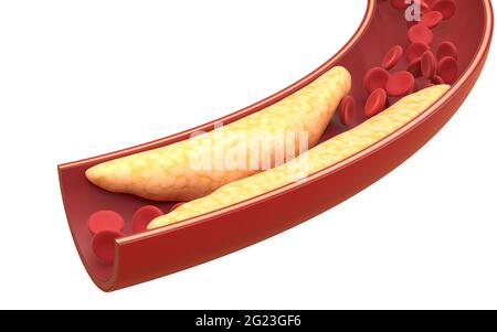 Fett- und rote Blutkörperchen in Blutgefäßen, 3d-Rendering. Digitale Zeichnung des Computers. Stockfoto