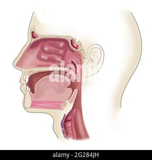 Seitenansicht des Kopfes, wo sich geschwollene und vergrößerte Mandeln befinden. Stockfoto