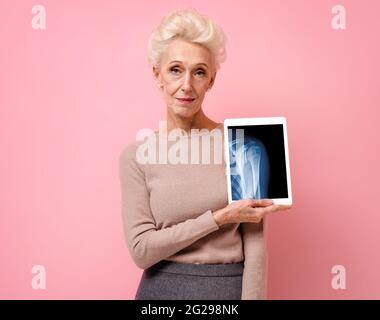 Attraktive Frau zeigt Röntgenaufnahme des Schultergelenks. Foto einer lächelnden älteren Frau mit Tablet in den Händen auf rosa Hintergrund. Medizinisches Konzept Stockfoto