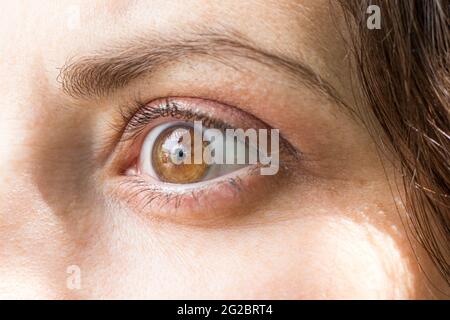 Menschliches Auge mit Nahaufnahme-Makro. Augenheilkunde, Korrektur von Myopie oder Hyperopie.