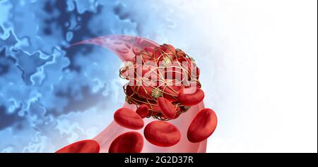 Blutgerinnsel Gesundheitsrisiko oder Thrombose medizinisches Illustrationskonzept Symbol als eine Gruppe von menschlichen Blutgerinnseln, die von klebrigen Blutplättchen zusammengeklumpt werden. Stockfoto