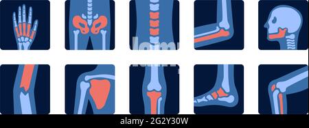Röntgenaufnahmen der menschlichen Gelenkanatomie mit Schmerzteilen. Röntgenuntersuchung von Knochen. Illustration für Medizin und Wissenschaft. Stock Vektor