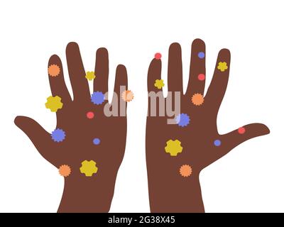 Abbildung: Schmutzige Hände. Hände Hände voll mit Bakterien und Viren. afroamerikanische ethnische Zugehörigkeit. Symbol für Hygiene. Vektor. Stock Vektor
