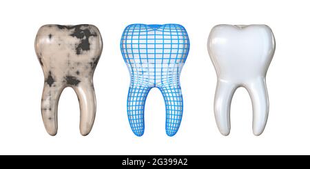 Phasen der Zahnheilung 3D Rendern Illustration isoliert auf weißem Hintergrund Stockfoto