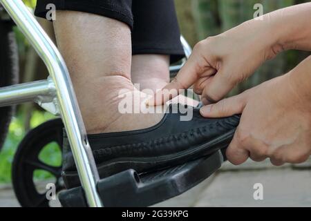 Ältere Frau geschwollene Füße drücken Sie die Taste Test auf Rollstuhl Stockfoto