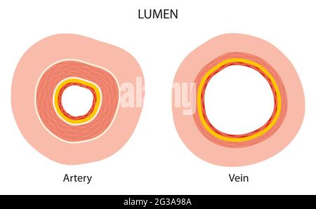 Unterschied zwischen Arterie- und Venenlumen Stockfoto