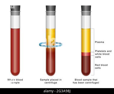 Diagramm mit der Blutzusammensetzung Stockfoto