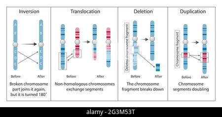 Chromosomenanomalie, Störung, Anomalie, Aberration oder Mutation Stockfoto