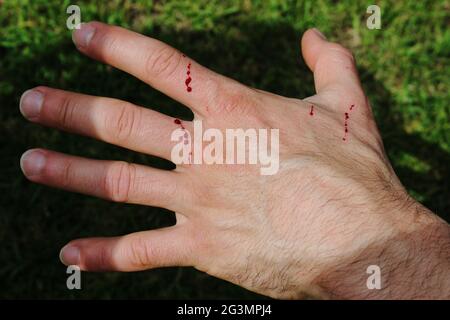 Die Hand des Mannes wurde von einer Katze im Garten frisch zerkratzt. Frisches Blut kommt aus der Hautschicht. Spritzer von Bluttropfen auf einer weißen Blume Stockfoto