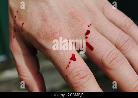 Die Hand des Mannes wurde von einer Katze im Garten frisch zerkratzt. Frisches Blut kommt aus der Hautschicht. Spritzer von Bluttropfen auf einer weißen Blume Stockfoto